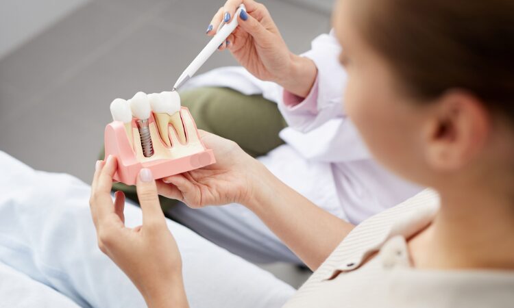 The cost of dental implants can be prohibitive for many patients. Understanding the various payment options available can help.